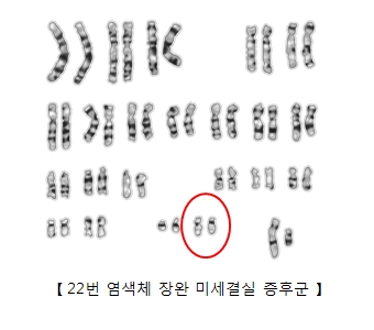 22번 염색체 장완 미세결실 증후군