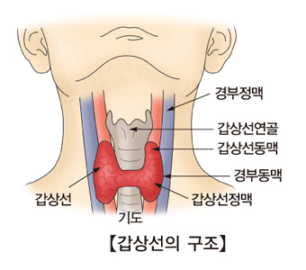 갑상선 유두암