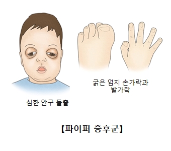 파이퍼 증후군