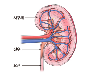 요독증