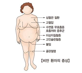 비만