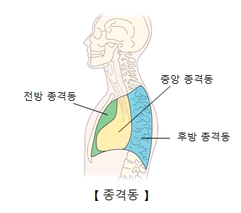 캐슬만병