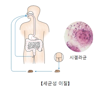 세균성이질