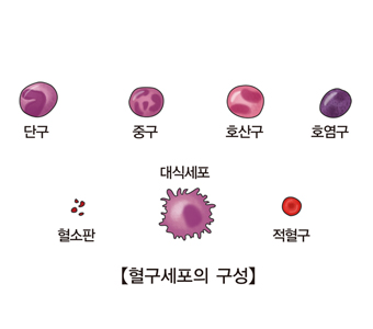 호산구 증가증