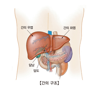 버드 키아리 신드롬