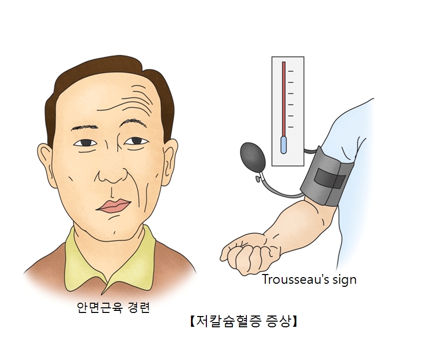 대사성 알칼리증