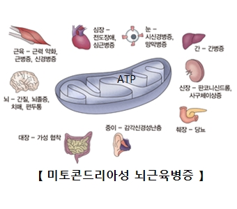 미토콘드리아성 뇌근육병증