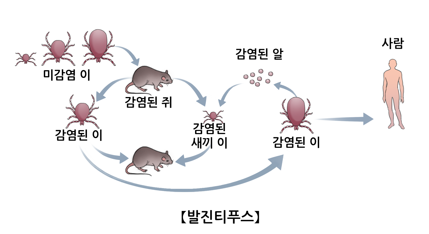 발진티푸스