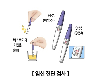 임신진단검사