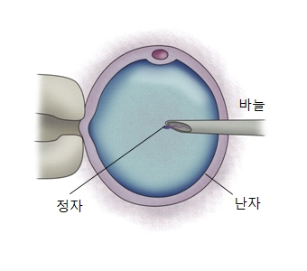 생식세포