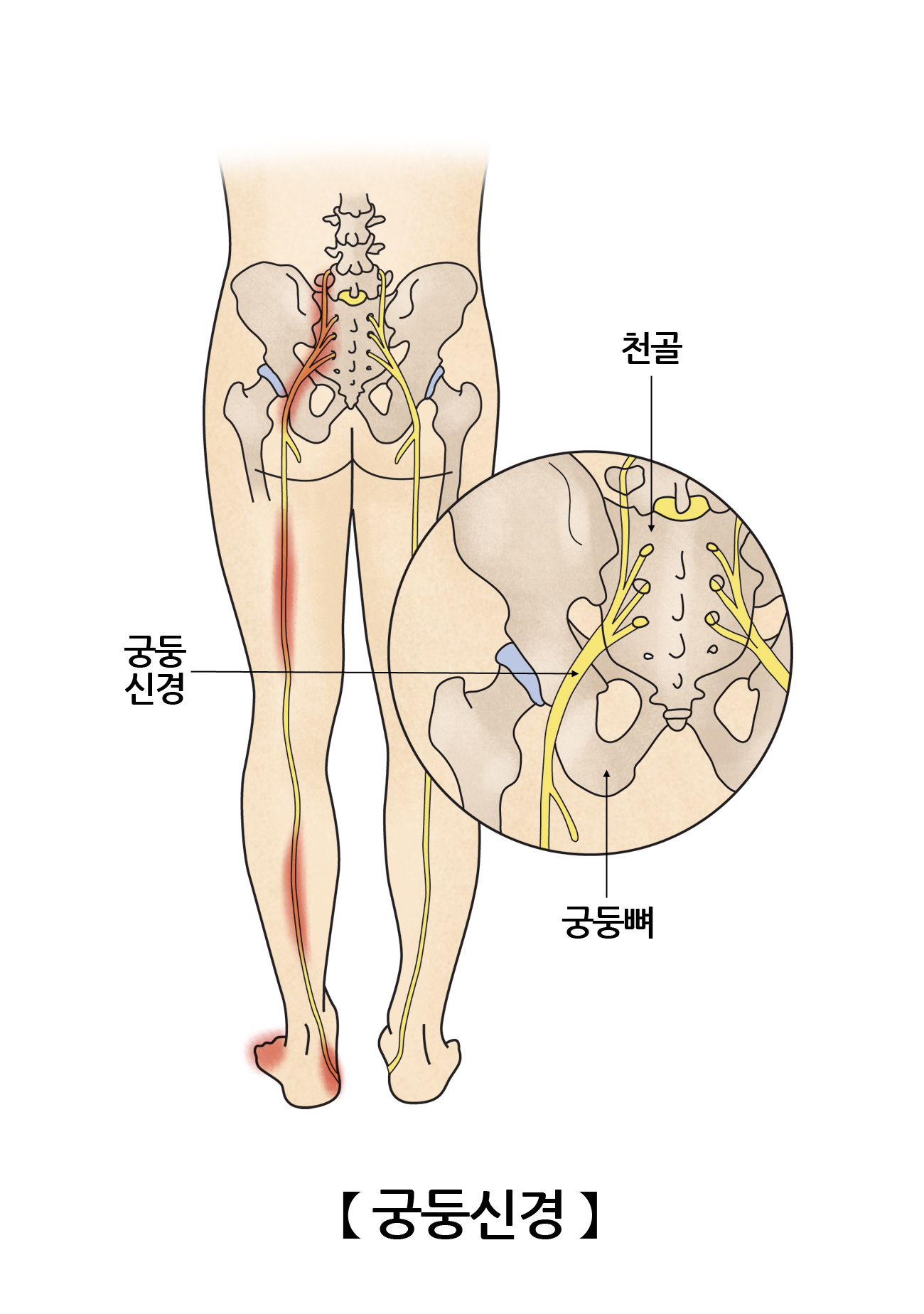 궁둥신경