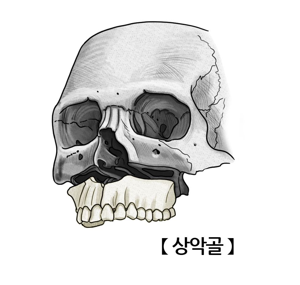 상악골