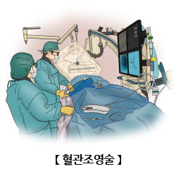 혈관조영술